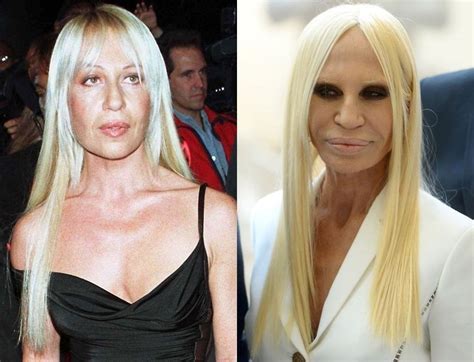 versace donatella before surgery|Donatella Versace without plastic surgery.